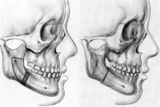 Chirurgiens maxillo-facial